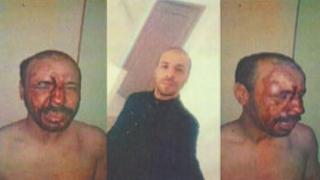 الـ”untm” بالدار البيضاء سطات يستنكر الاعتداء على مناضل الاتحاد داخل مستشفى سيدي عثمان