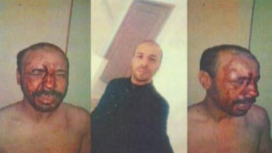 الـ”untm” بالدار البيضاء سطات يستنكر الاعتداء على مناضل الاتحاد داخل مستشفى سيدي عثمان